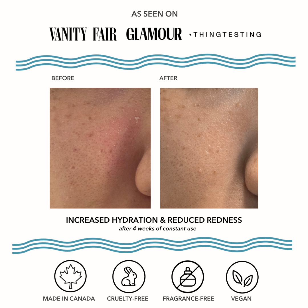 Vacation Skin redness recovery skincare for sensitive, reactive skin