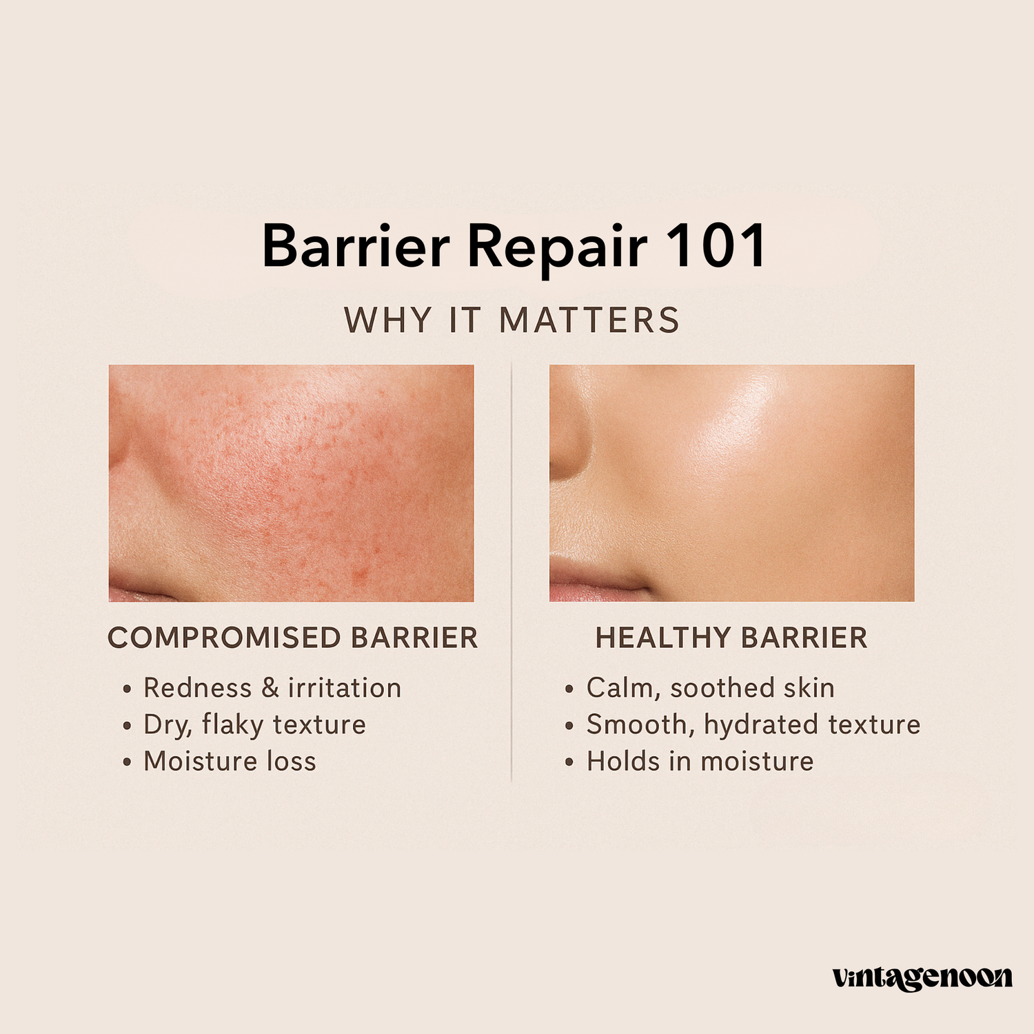Why Barrier Repair Is Essential for Sensitive Skin